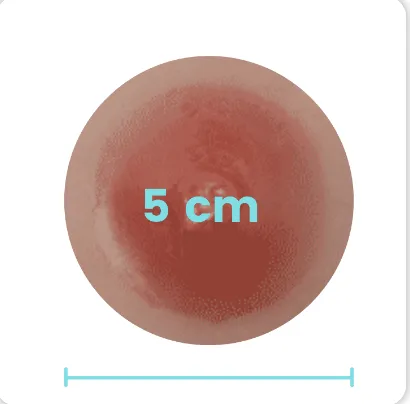 5cm