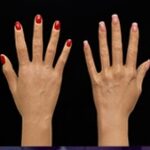 Hard Hands